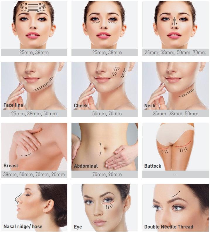 Neo Eye Thread Lifting - Eye Cannular PDO