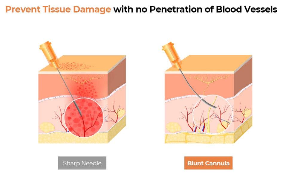 Neo Filler Cannula